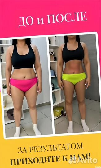 Криолиполиз LPG массаж Коррекция фигуры