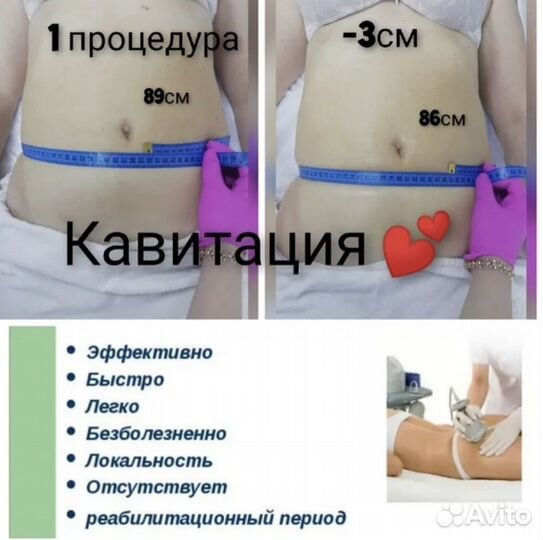 Вакуумный массаж,кавитация,липолиз,rf лицо,тело