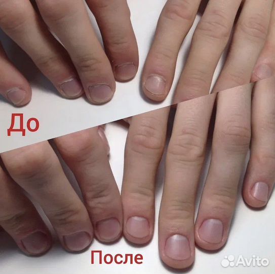 Услуги маникюра на дому