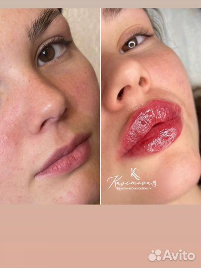 Врач- Дерматолог. Косметолог. Онколог