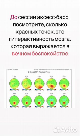 Массаж access bars (Аксесс Барс)