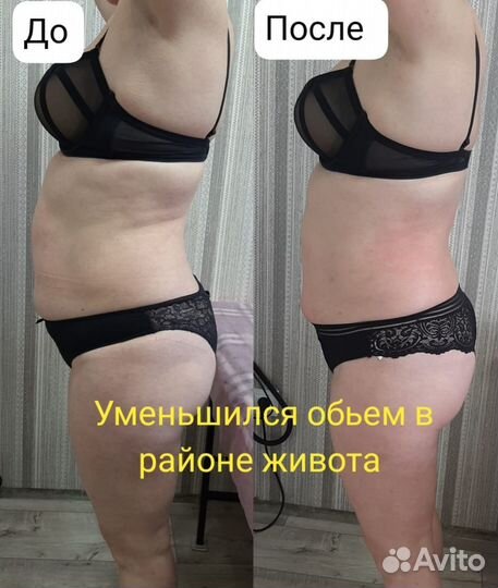 Аппаратный антицеллюлитный массаж