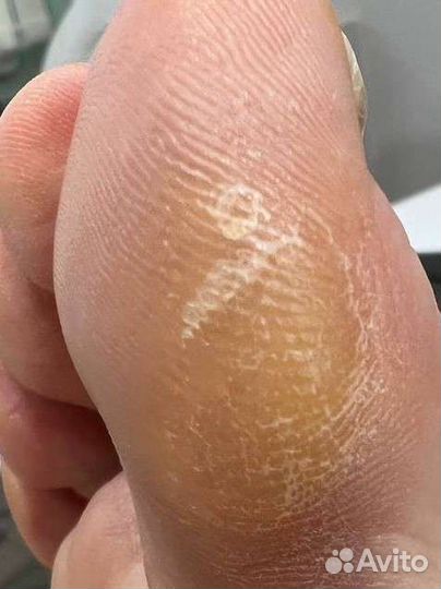 Медицинский педикюр, подолог)