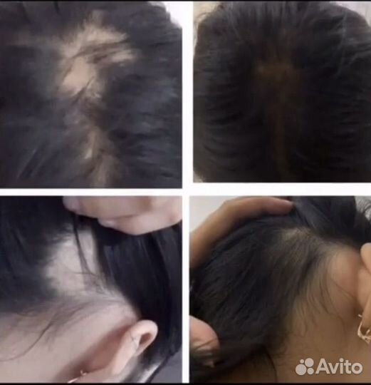 Спрей против выпадения волос Атоми