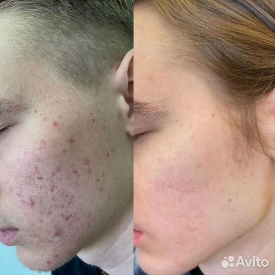 Косметолог / Ботокс / Чистка / Контурная пластика