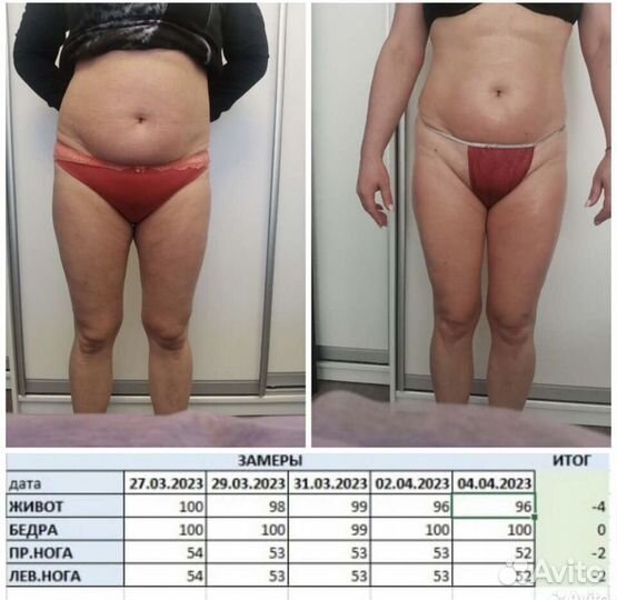 LPG-массаж тела/лица Orig аппарат опыт 15лет