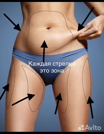 Криолиполиз New система липосакции