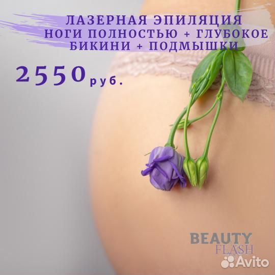Лазерная эпиляция