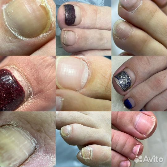 Курсы педикюра подология