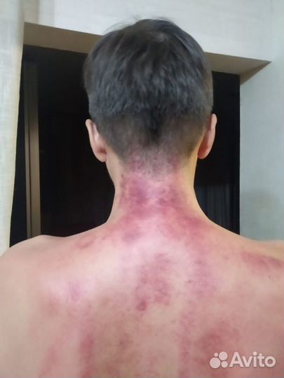 Оздоровительный массаж