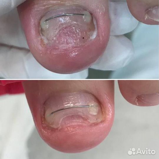 Услуги подолога