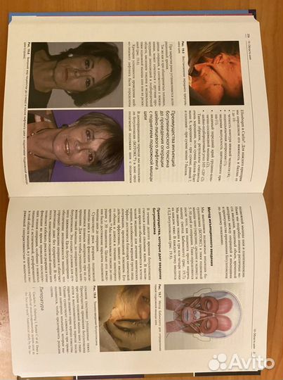 Инъекционные методы в косметологии 2018 Б. Ашера