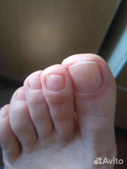 Педикюр. Медицинский педикюр. С выездом на дом