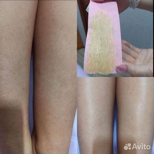Восковая депиляция