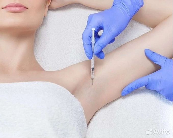 Ботулинотерапия. Лечение гипергидроза