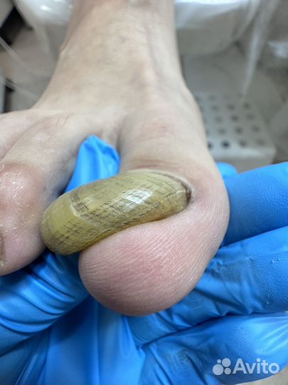 Услуги подолога. Дорого