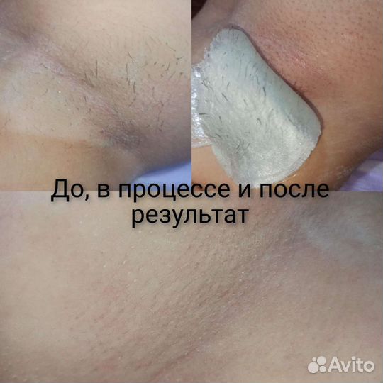 Восковая депиляция
