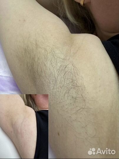 Мастер по шугарингу