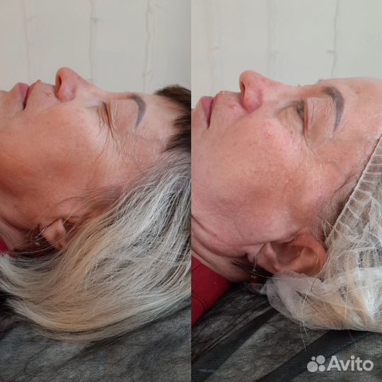 Косметик эстетист