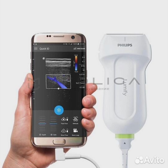 Узи аппарат Philips Lumify