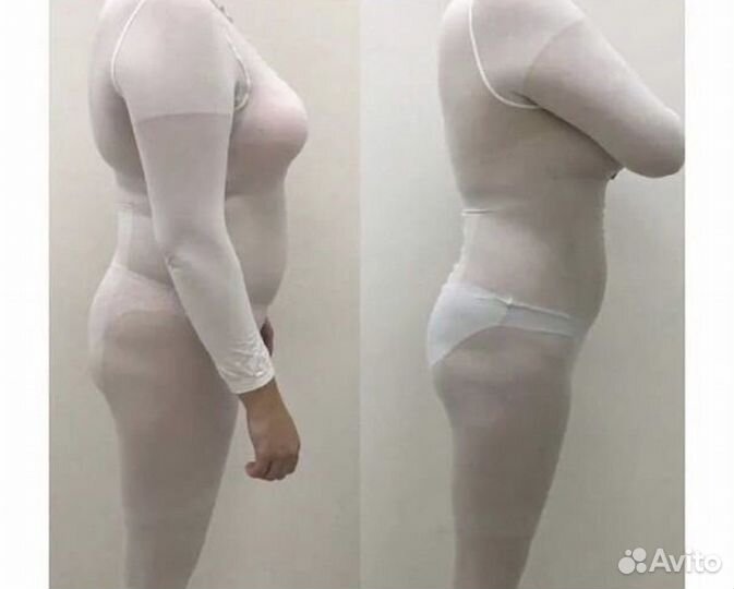 Абонемент Lpg массаж / Комплекс процедур