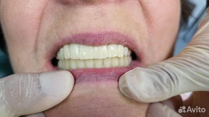 3d моделирование в exocad