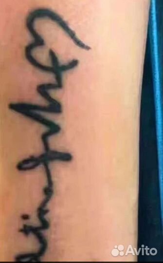 Лазер для удаления тату, веснушек итд