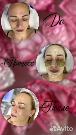 Аппаратная косметология