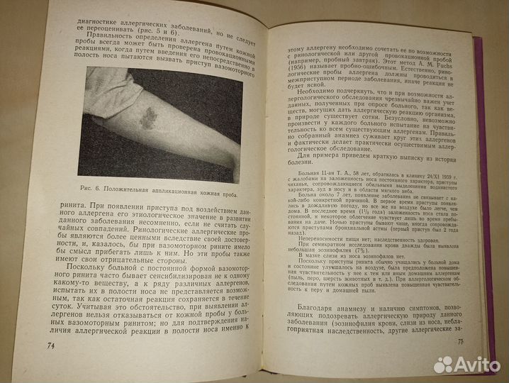 Вазомоторный ринит. Дайняк. 1966