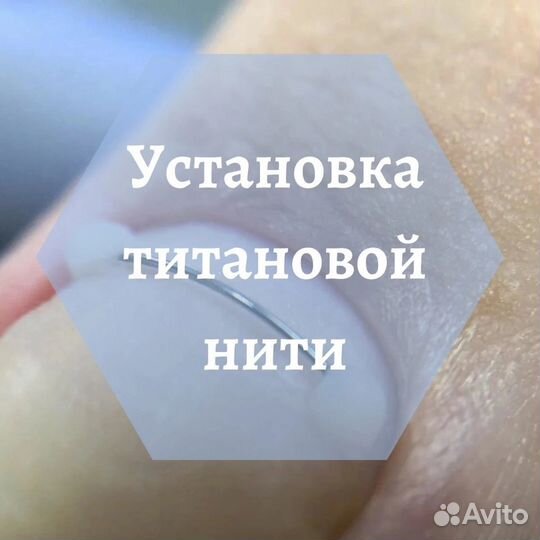 Педикюр