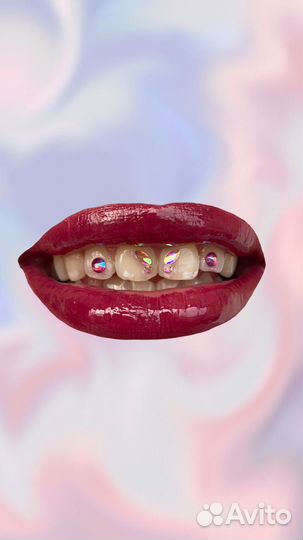 Скайсы установка