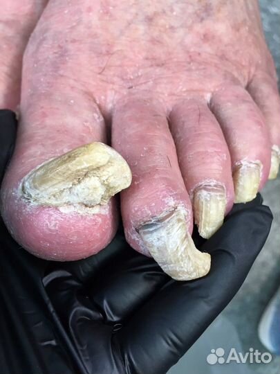 Специалист Подолог, педикюр, маникюр