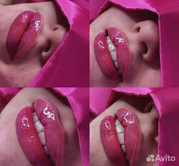 Косметолог,липоредукция, губы,углы,ботокс,ягодицы