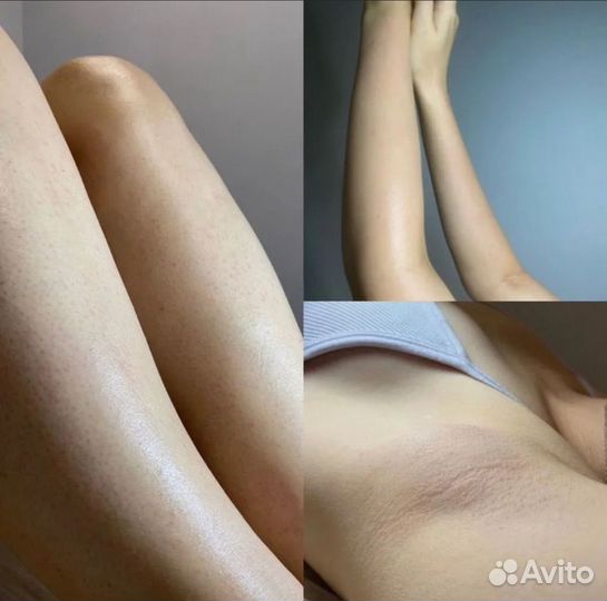 Шугаринг депиляция