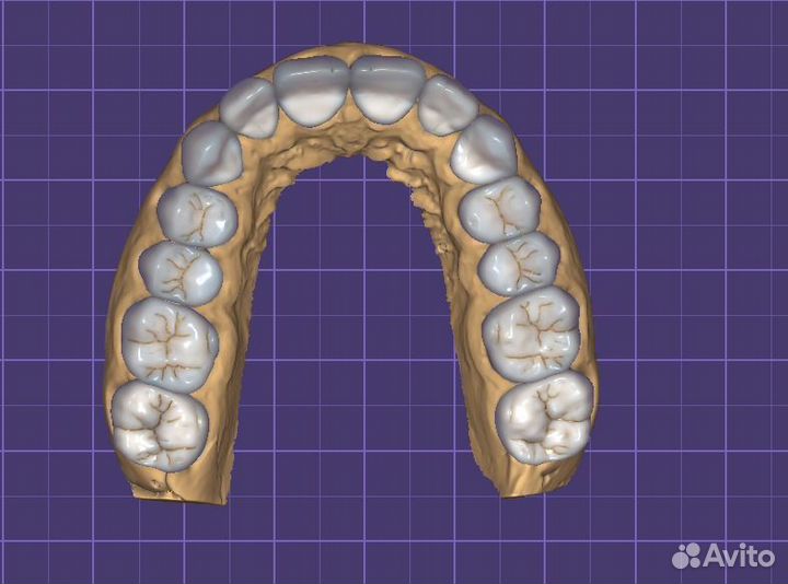 Установка exocad и другие По, 3D моделирование