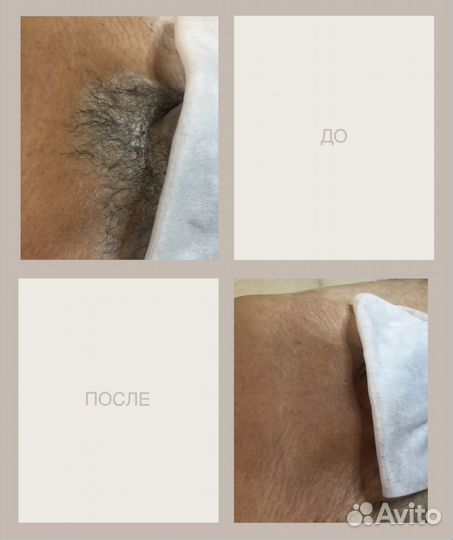 Шугаринг Мужской-женский сахарная депиляция