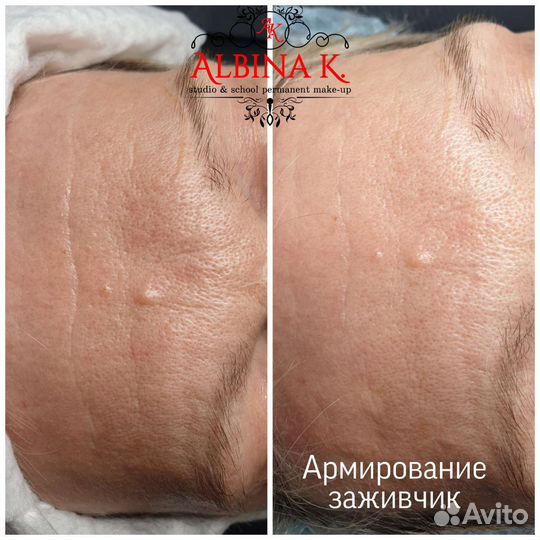 Услуги косметолога