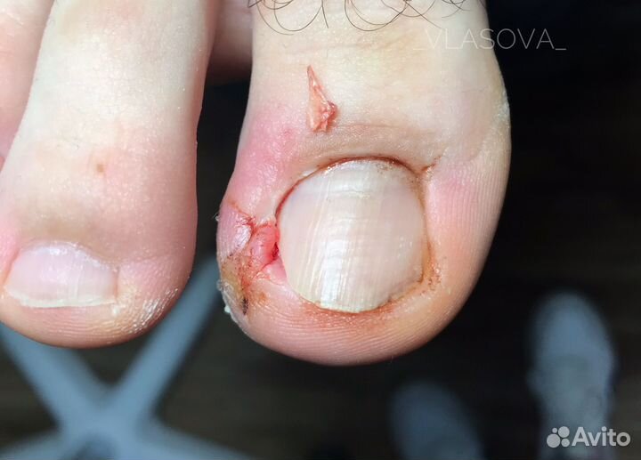 Подология маникюр педикюр