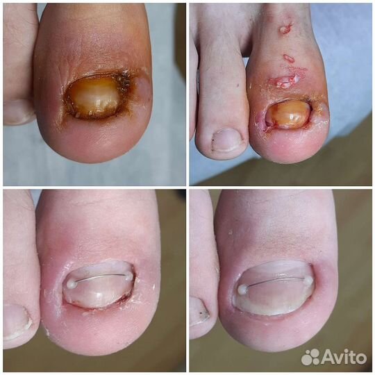 Подолог Алтуфьево Бибирево свао