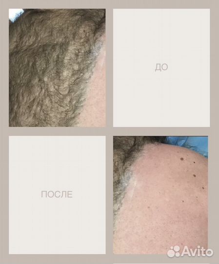 Шугаринг Мужской-женский сахарная депиляция