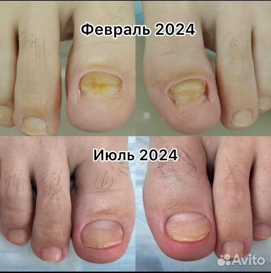 Услуги подолога