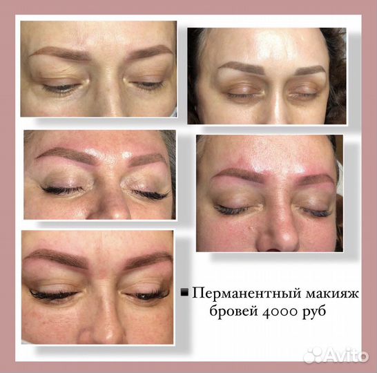 Косметолог. Пирсинги. Перманент, RF-лифтинг