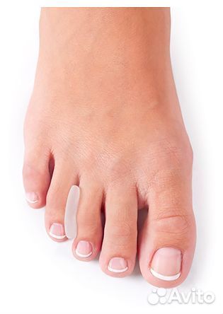 Приспособления коррегирующие molli, ortmann