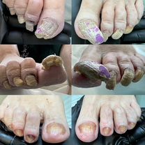 Подолог, Нижний Новгород