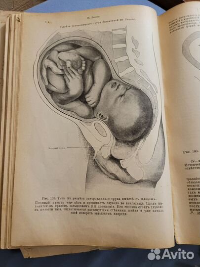 Руководство по акушерству издание 1907г