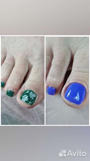 Аппаратный педикюр