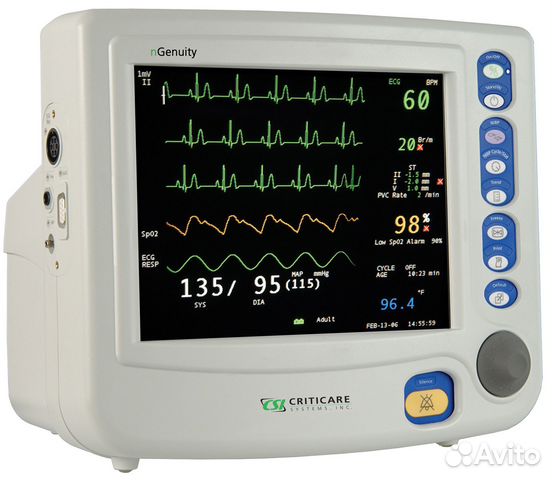 Прикроватные мониторы пациента это
