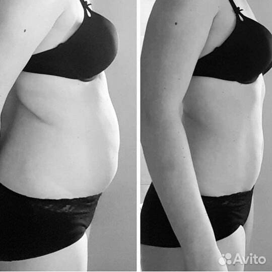 Аппаратный +Вакуумный массаж + RF-лифтинг