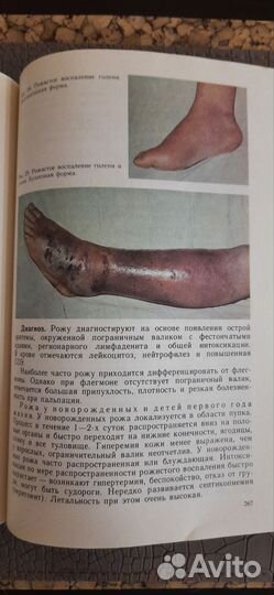 Учебник по инфекционным болезням у детей