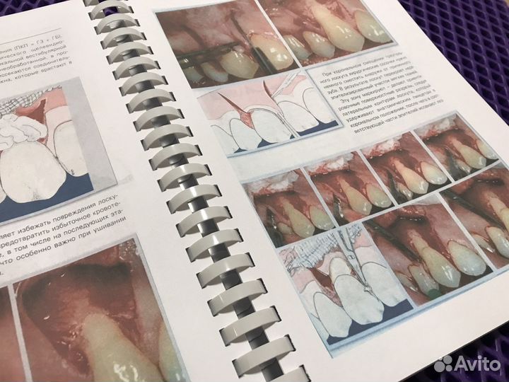 Пластическая хирургия мягких тканей полости рта